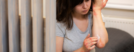 Dermatite de contato e alergias